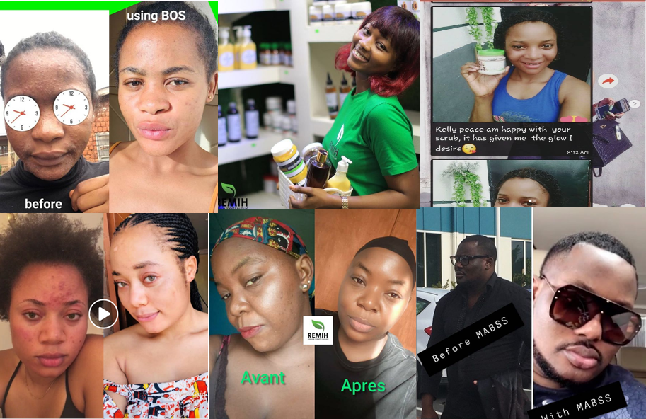 Top 5 Cameroon Organic Skin Care Brands & Products for Perfect Glowing 