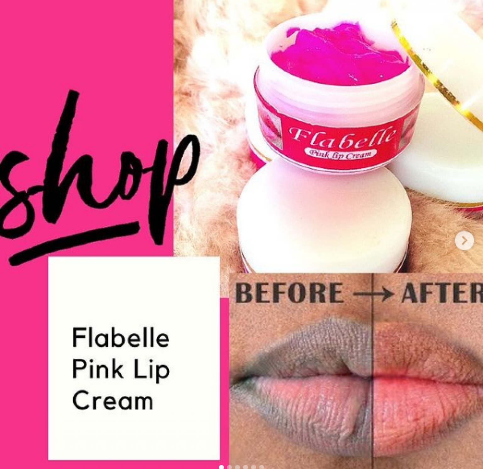 Best Products To Get Natural Pink Lips In Cameroon Best Pink Lips Cream Balm Cameroon For Sale