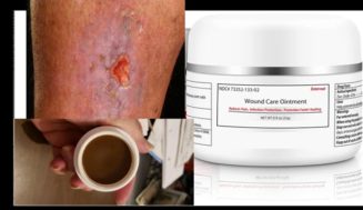 Fast Wound Healing Ointment for Diabetic Wounds, Venous leg Ulcer, Pressure Sores, Burns, Cuts, Scrapes – Best in Cameroon – Say Good Bye to that stubborn wound