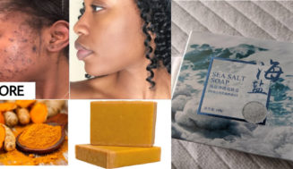 Best Soaps for Pimples & Dark Spots in Cameroon